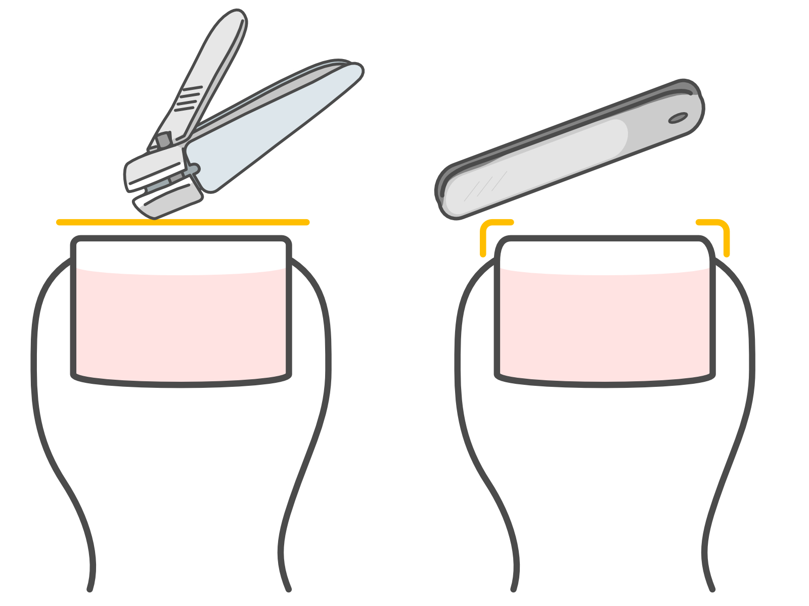 江ノ島　巻き爪　爪切り
