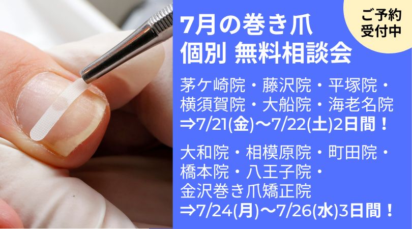 八王子市　巻き爪　無料相談会