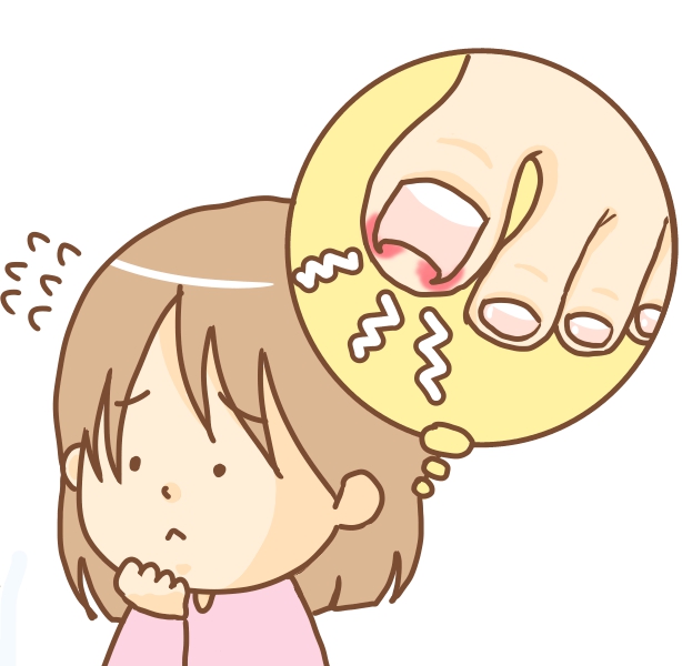 八王子市　巻き爪　女性