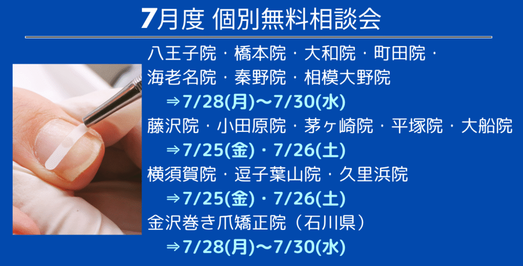 八王子市　巻き爪　無料相談会