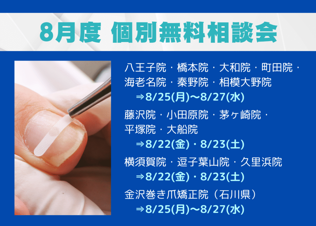 八王子市　巻き爪　無料相談会