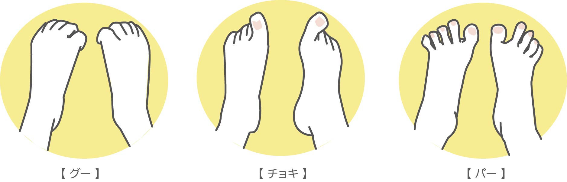 秦野市　巻き爪　足指