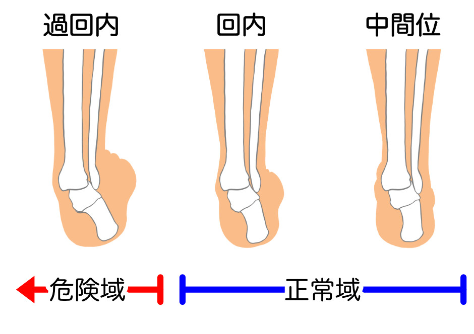 秦野市　巻き爪　足