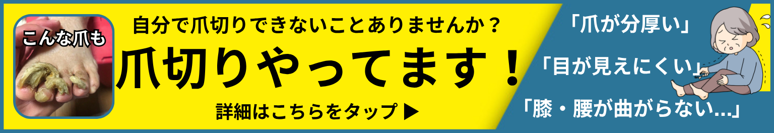 相模原市橋本　巻き爪　爪切り