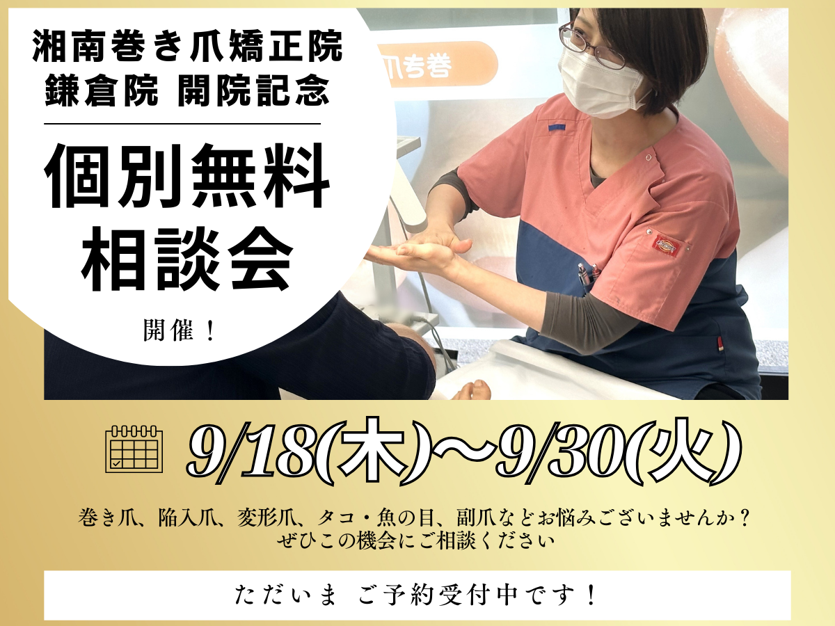 鎌倉市　巻き爪　無料相談会