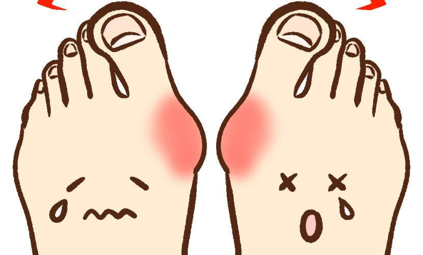 鎌倉市　巻き爪　外反母趾