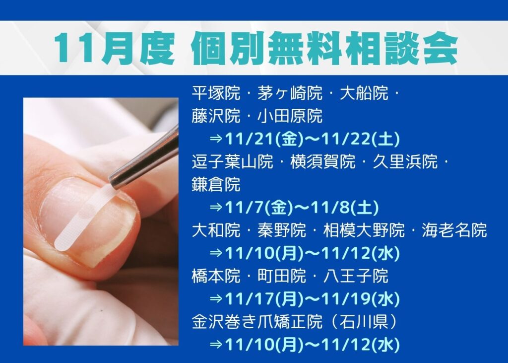 鎌倉市　巻き爪　無料相談会