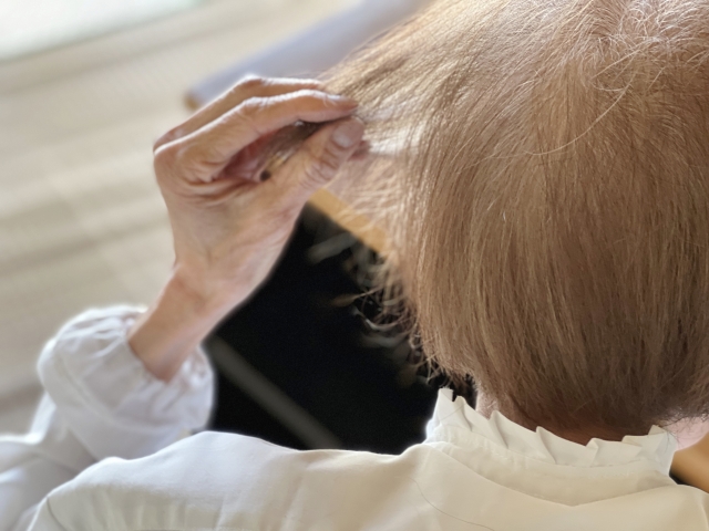 鎌倉市　巻き爪　女性