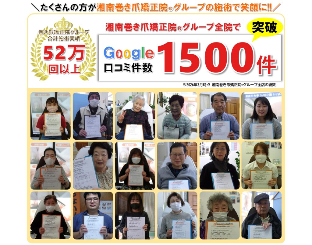 鎌倉市　巻き爪　お客様の声