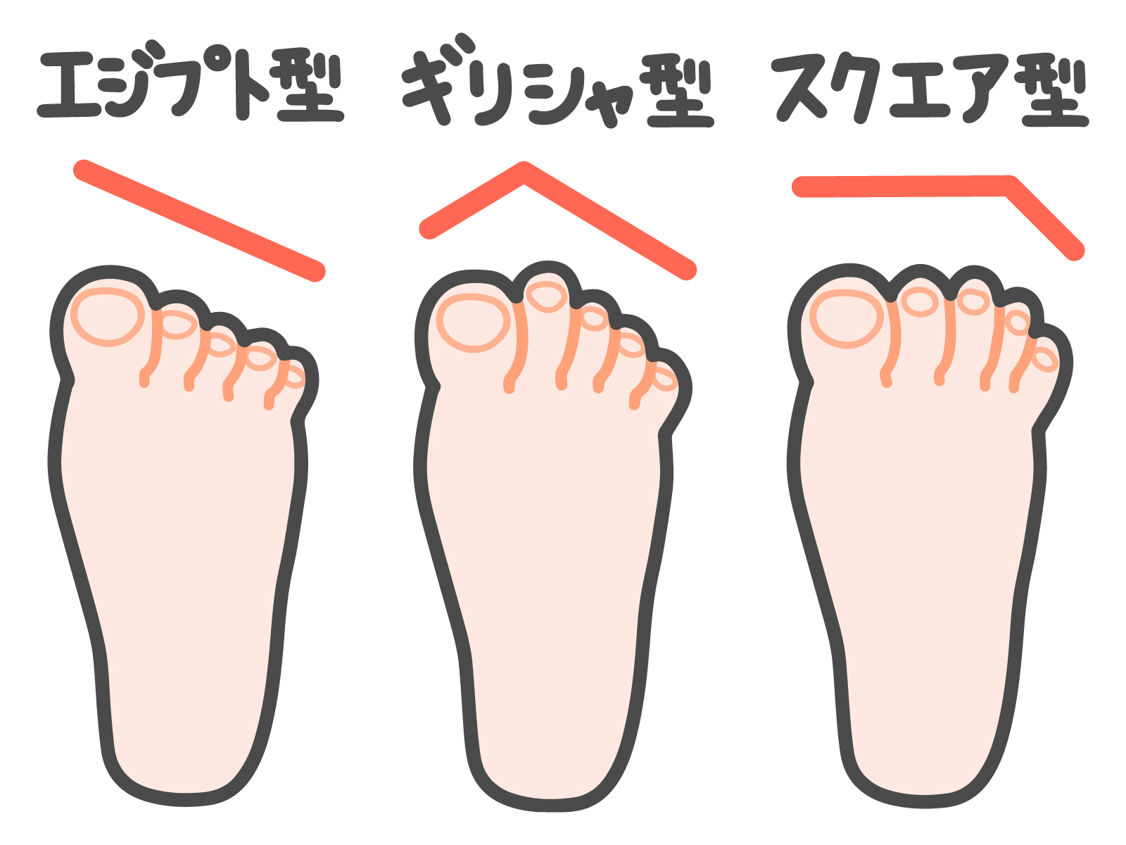 金沢市　巻き爪　爪先