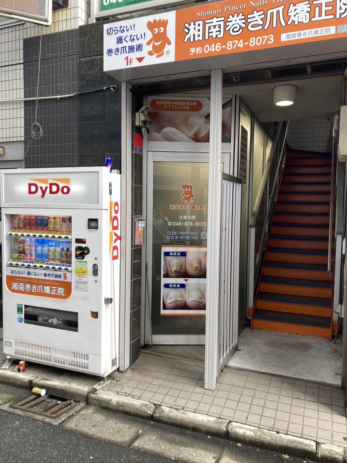 久里浜　巻き爪　外観