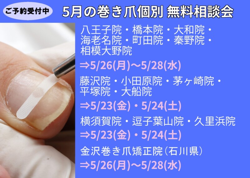 久里浜　巻き爪　無料相談会