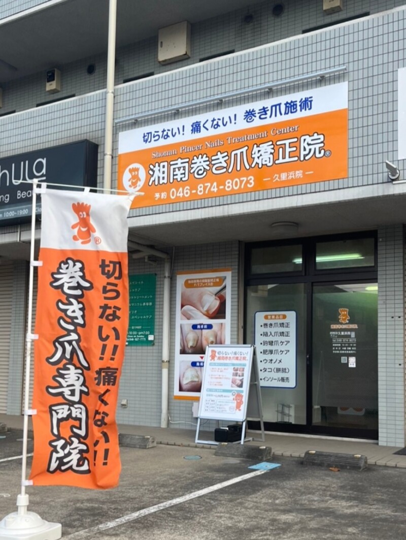 久里浜　巻き爪　外観