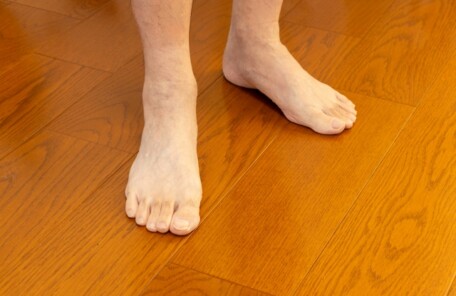 久里浜　巻き爪　足