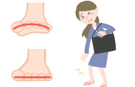 久里浜　巻き爪　開張足