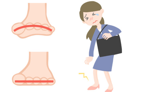 久里浜　巻き爪　開張足