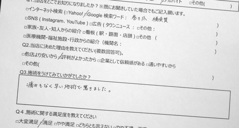 久里浜　巻き爪　お客様の声