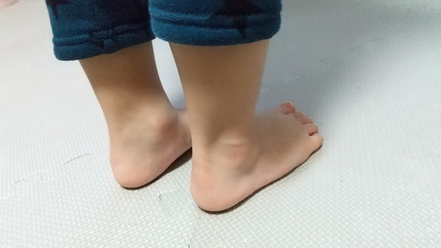 久里浜 巻き爪 足