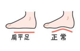 久里浜　巻き爪　扁平足