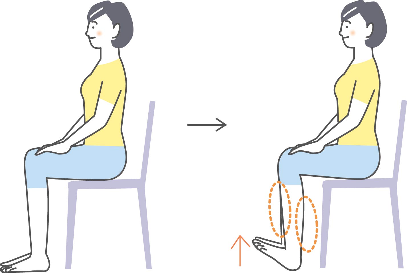 小田原市 巻き爪 女性