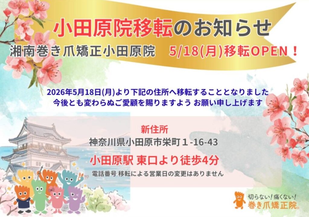 小田原市　巻き爪　お知らせ