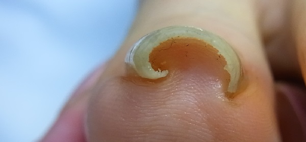 湘南台　巻き爪　バナー