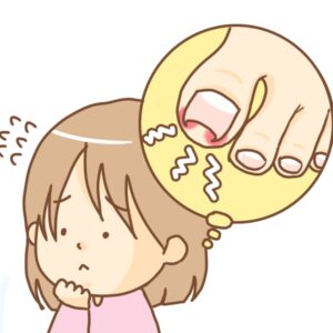 湘南台　巻き爪　女性