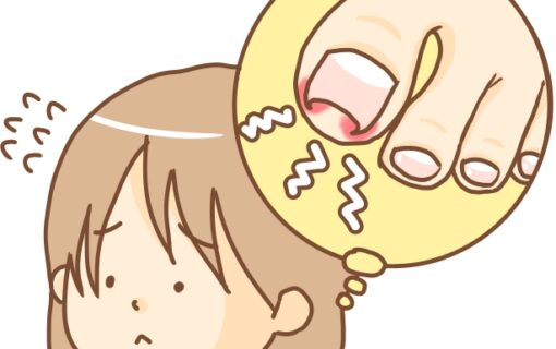 湘南台　巻き爪　女性