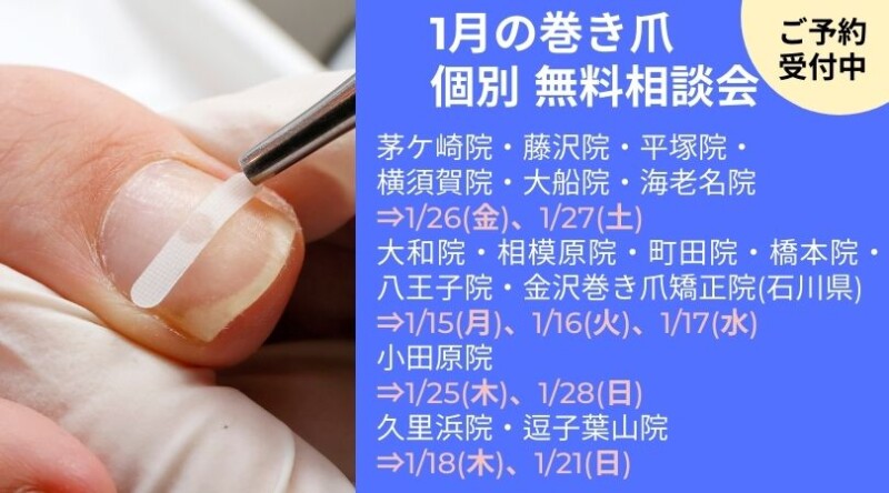 逗子市　巻き爪　無料相談会