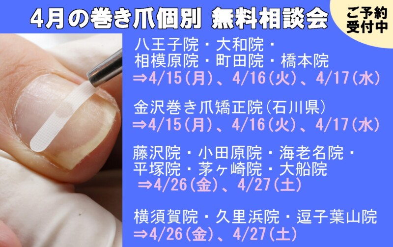 逗子市　巻き爪　無料相談会