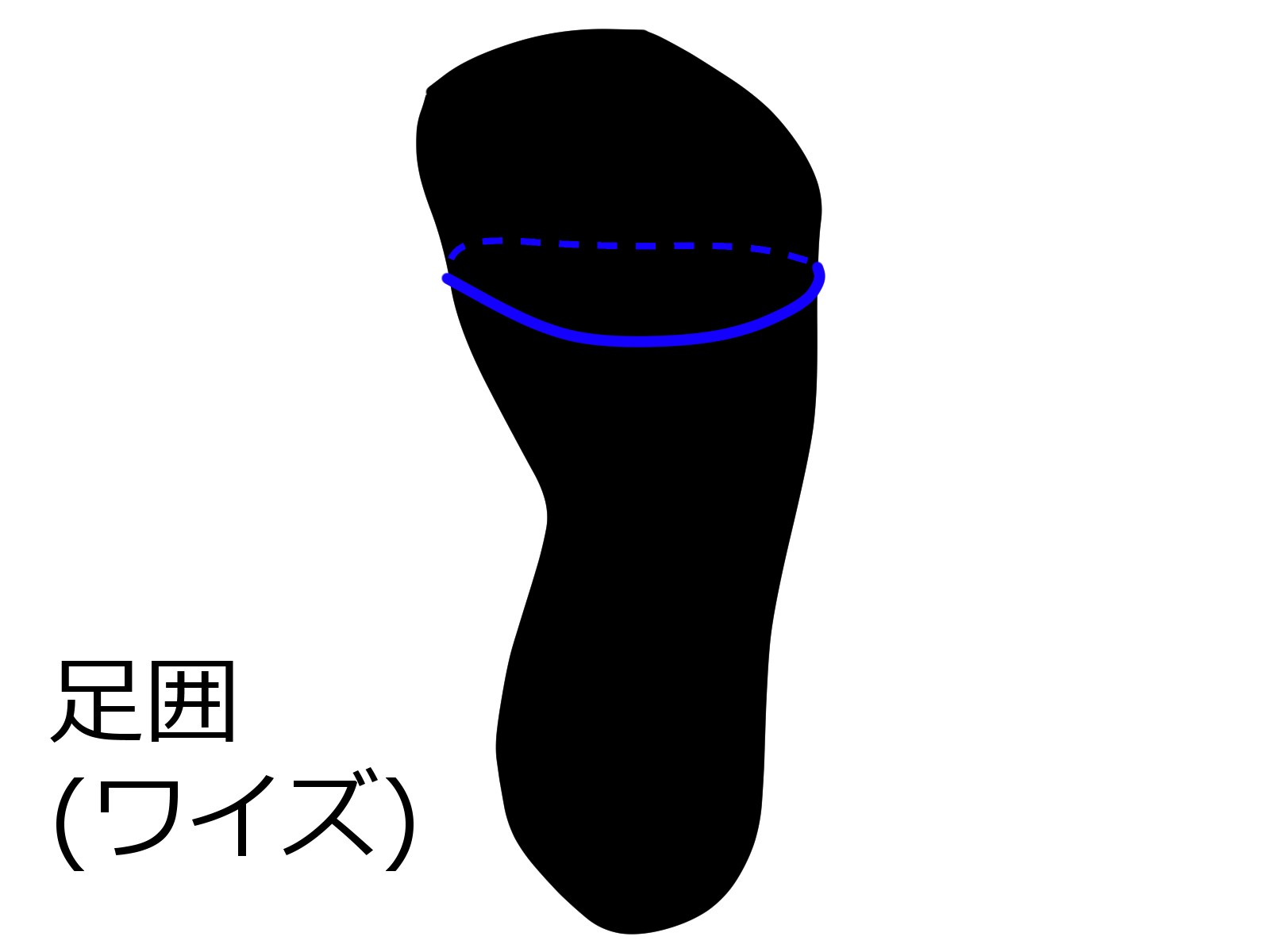 逗子市　巻き爪　足囲