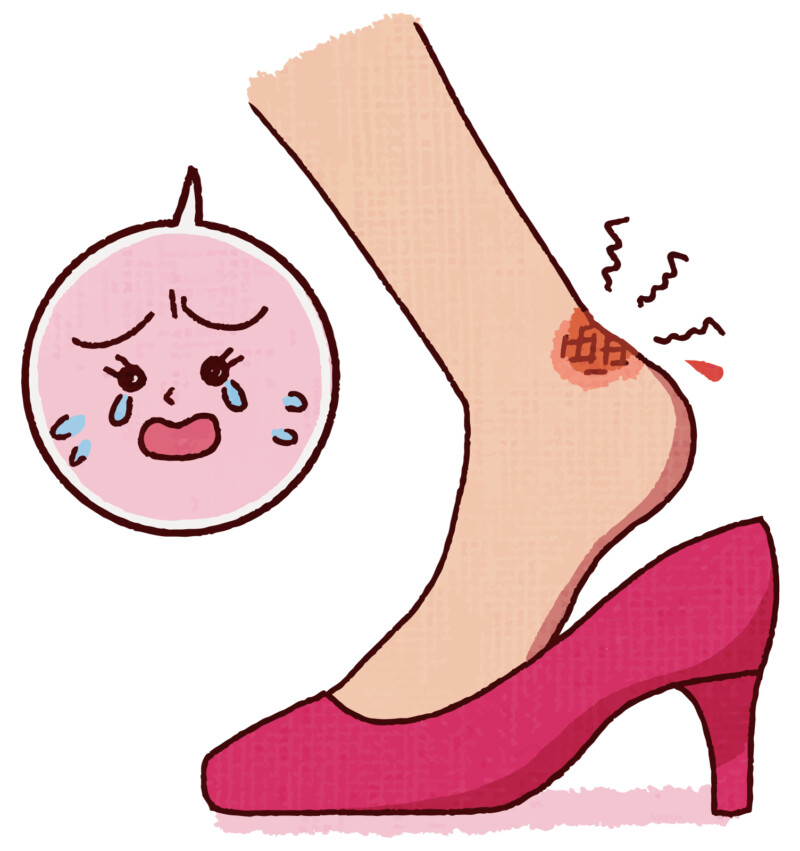 逗子市　巻き爪　ハイヒール
