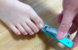 逗子市　巻き爪　爪切り