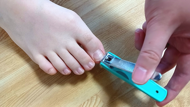 逗子市　巻き爪　爪切り