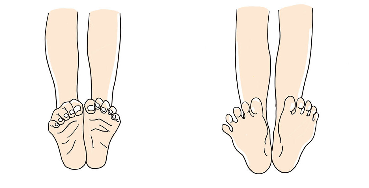 逗子市　巻き爪　ストレッチ