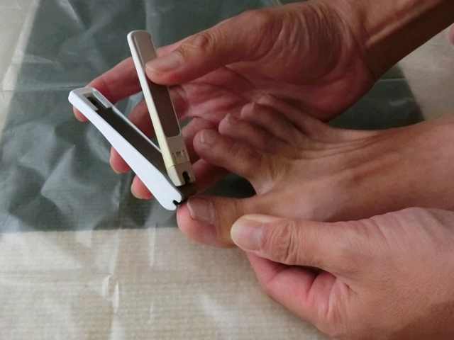 逗子市　巻き爪　爪切り